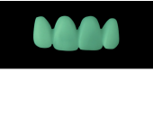 Cod.C21Facing : 15x  wax facings-bridges,  SMALL, Tapering ovoid, TOOTH 12-22, compatible with Cod.A21Lingual,TOOTH 12-22 for long-term provisionals preparation
